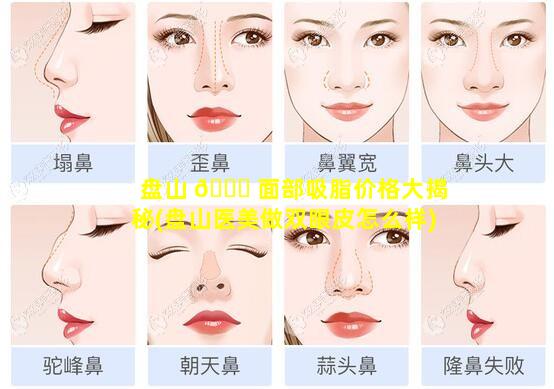 盘山 🐒 面部吸脂价格大揭秘(盘山医美做双眼皮怎么样)